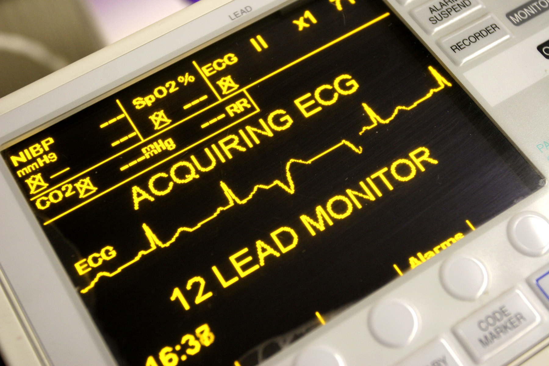 12-Lead-Monitor-ECG-Aquiring
