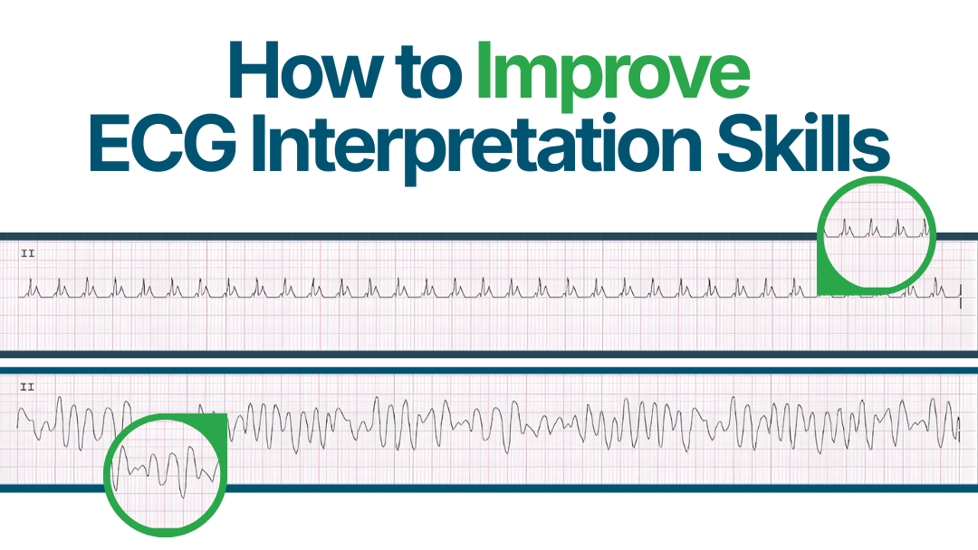 ECG Interpretation