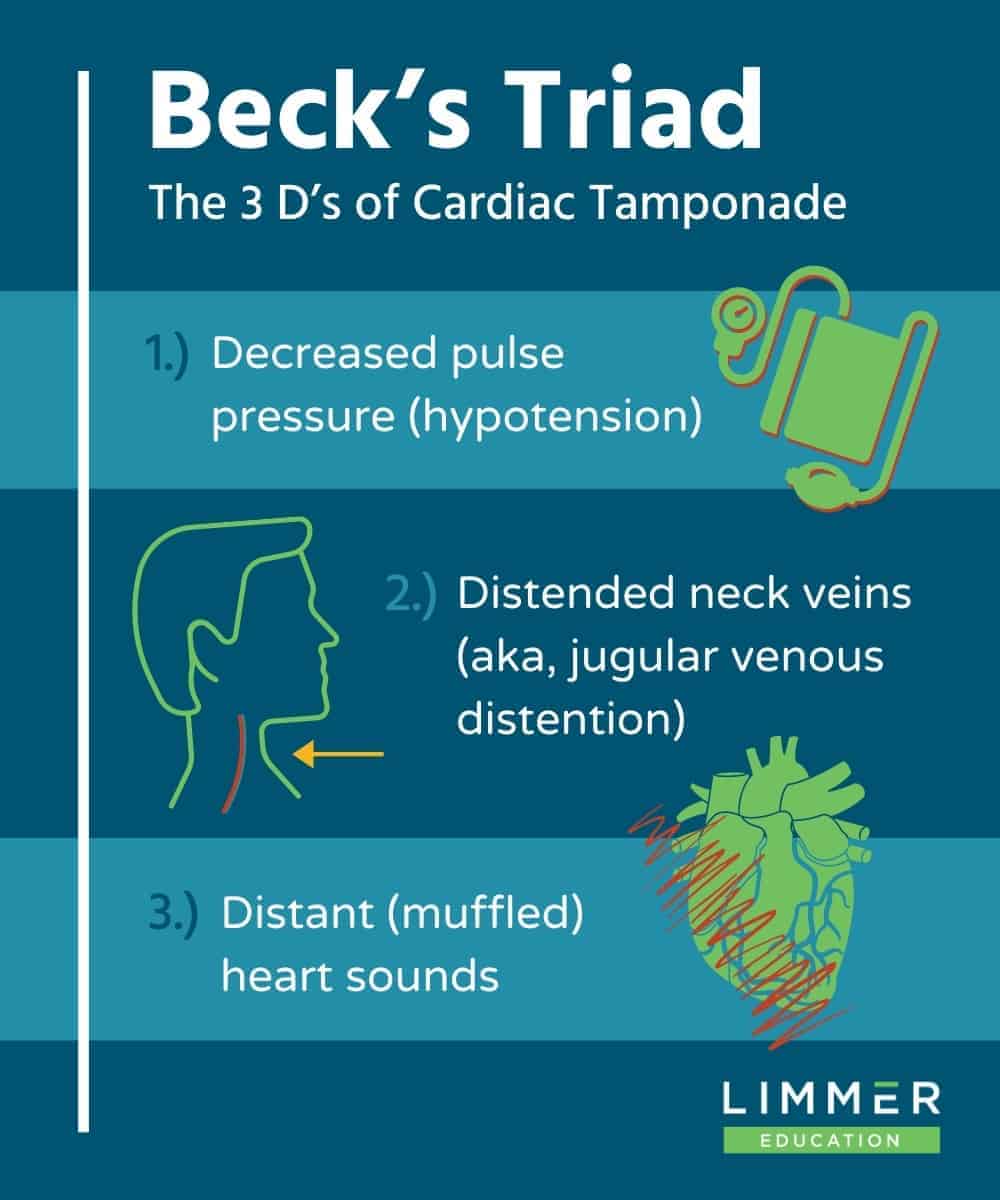 infographic of Beck's Triad: hypotension, jugular venous distention, muffled heart sounds.