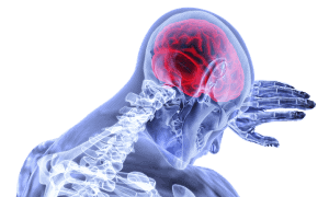 xray image of brain highlighted red