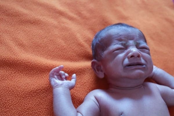 cyanotic infant on orange blanket