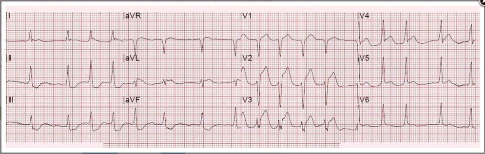 screenshot of ecg