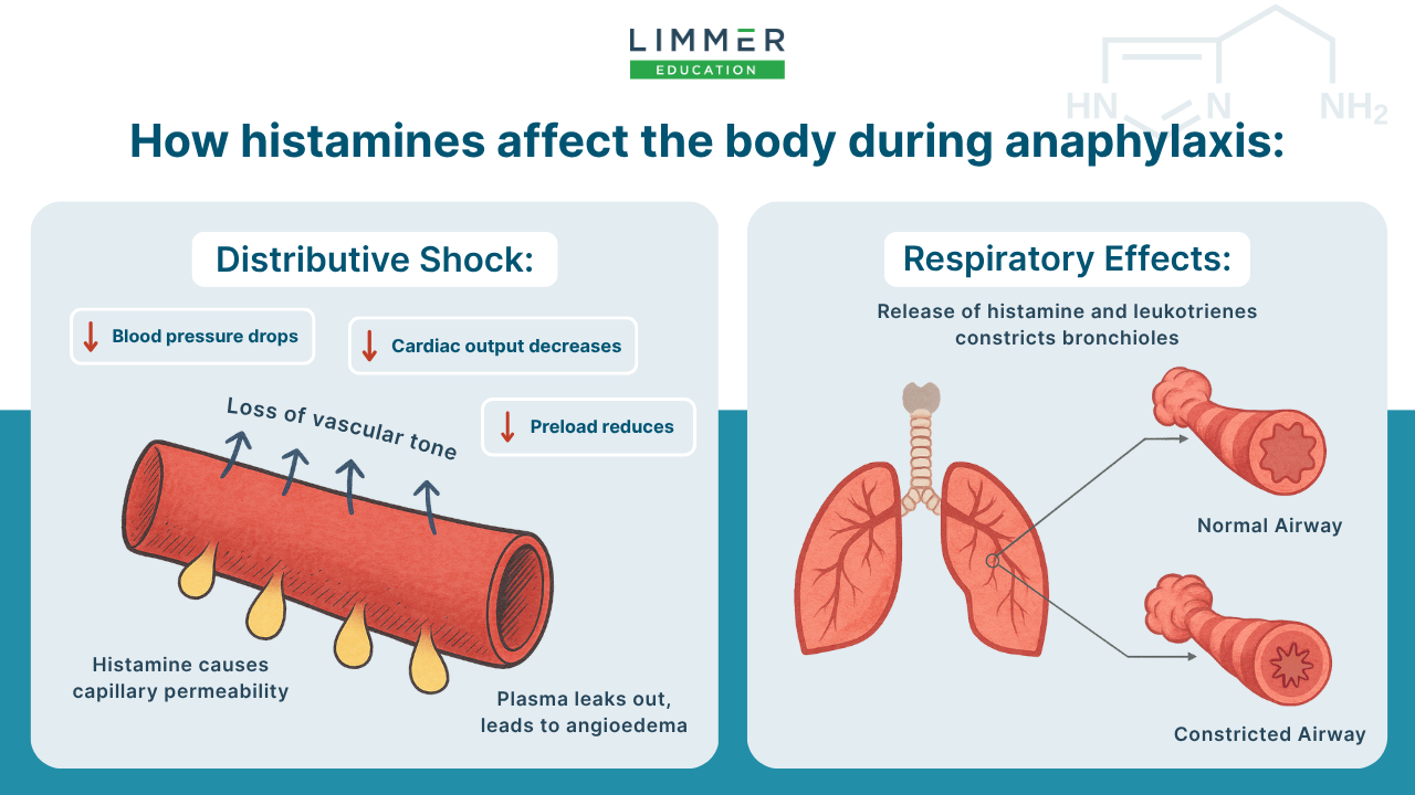 Graphic showing how histamines contribute to distributive shock and constricted airways during anaphylaxis