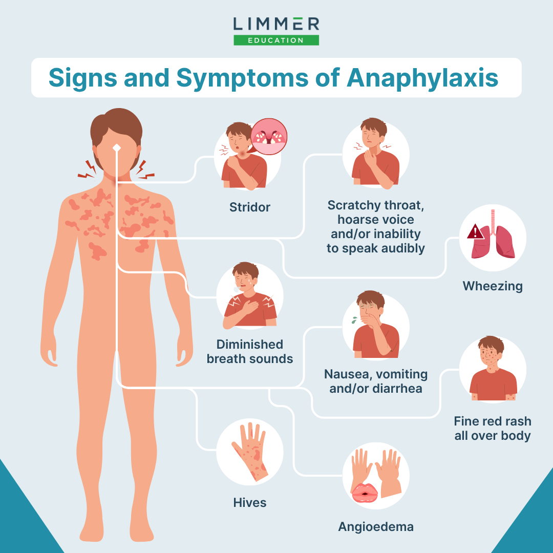 graphic showing common signs and symptoms of anaphylaxis