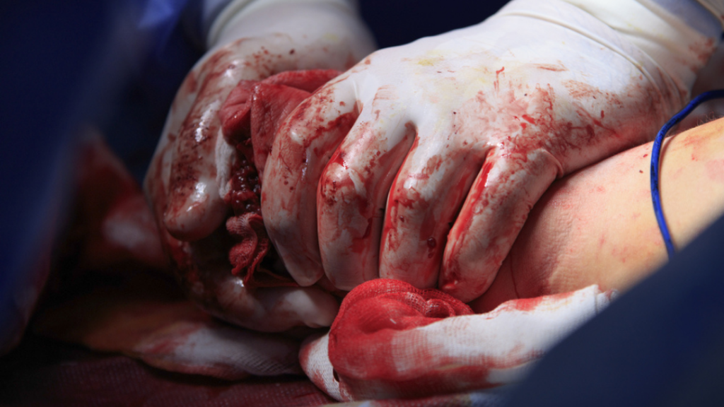 gloved emt hands working to get bleeding control