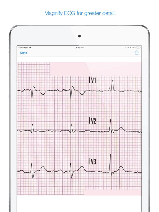 screenshot of ECG example with magnify for greater detail option
