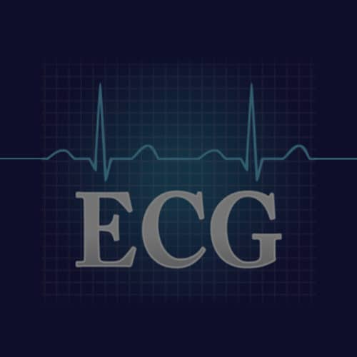 ECG Challenge