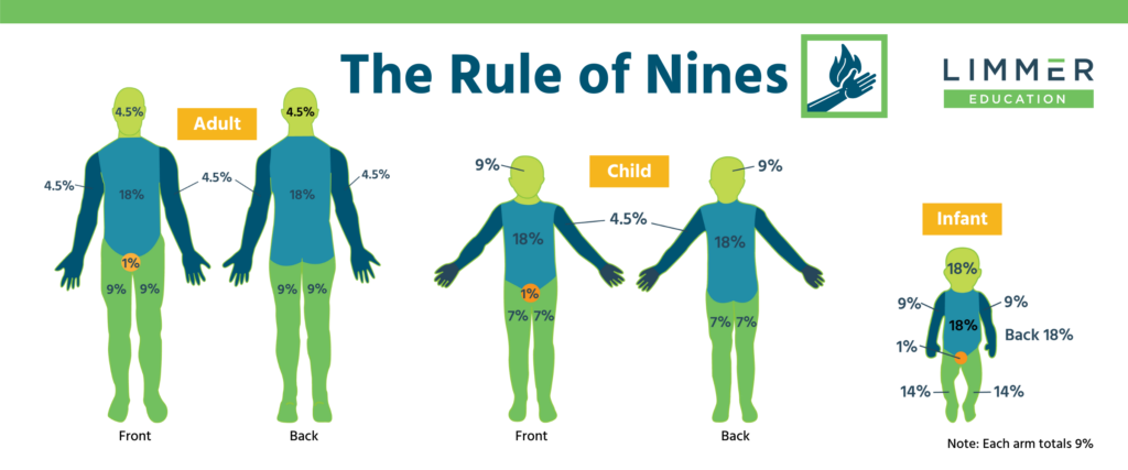Rule Of Nines Burn Chart Children