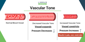 Images showing normal, decreased and increased vascular tone