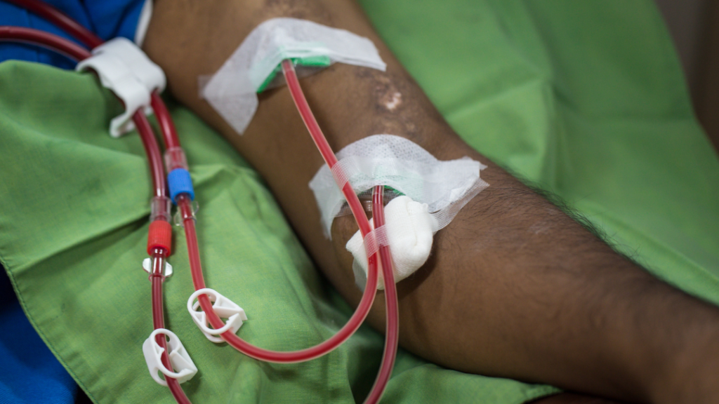 dialysis patient arm