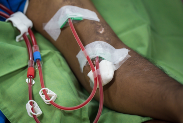dialysis patient arm